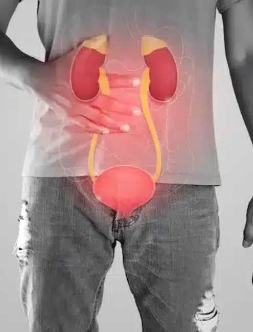 diagnostico-urologico-integral-en-cdmx.webp