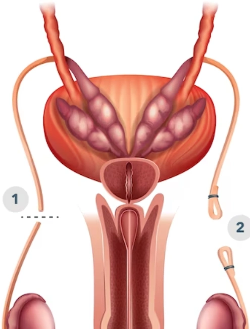 urologo-cerca-de-roma-sur-cdmx.webp