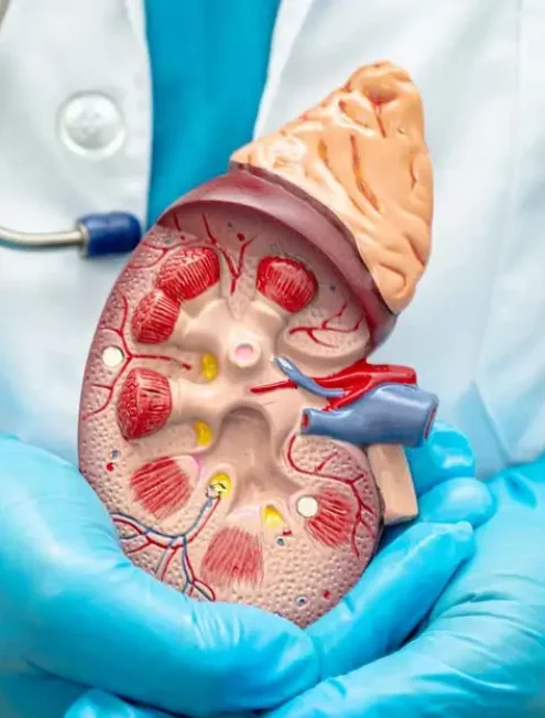 urologo-con-experiencia-en-calculos-en-cdmx.webp