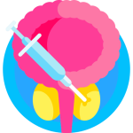 costos-cirugia-de-prostata-laser