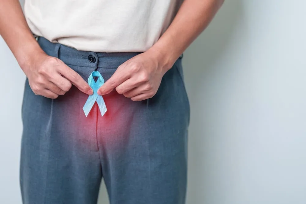 Atención especializada para el cáncer de próstata en CDMX