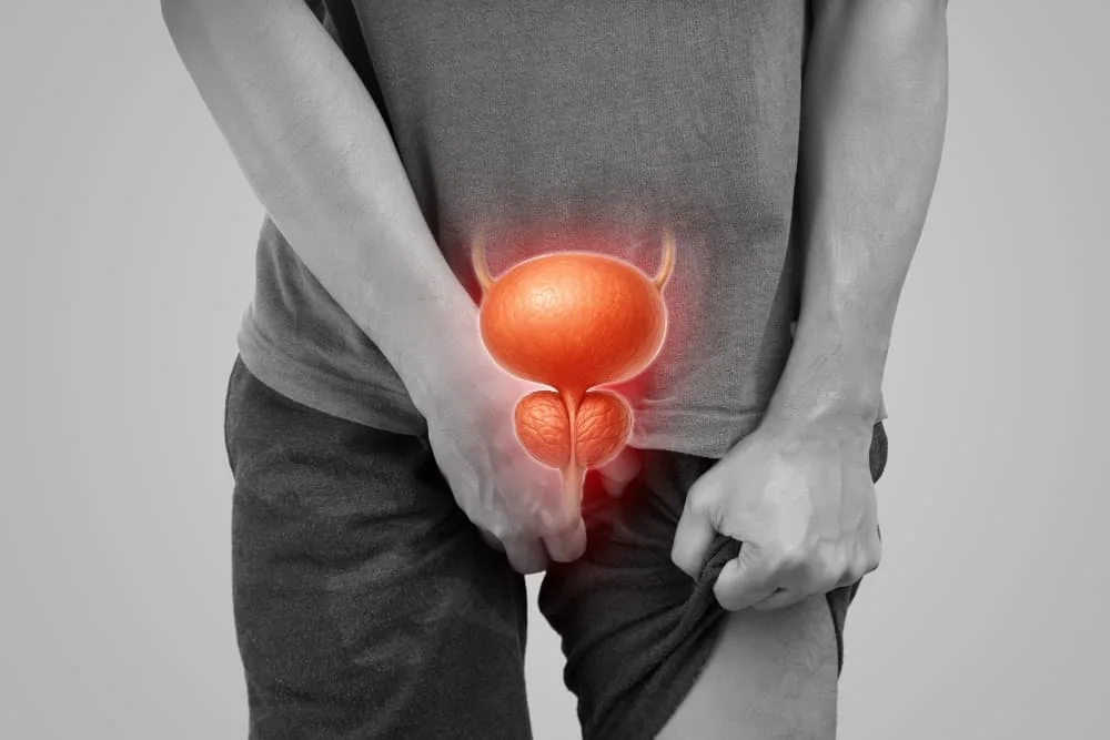 ¿Qué especialista trata la hiperplasia prostática?